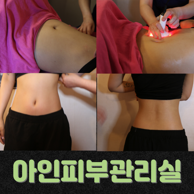  똥배처럼 보이는 복부?, 날씬한 몸매를 위한 천안 신부동 헤리티지 복부관리