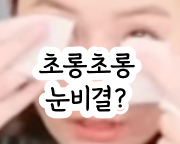 정유미 눈알티슈 다래끼 예방 눈기름샘 청소 눈꺼풀 마이봄샘 세정제 장단점 비교