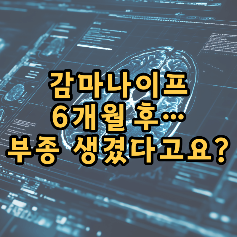 감마나이프 후 부종, 6개월 MRI에서 나타난 이유와 두통 경험 솔직 후기