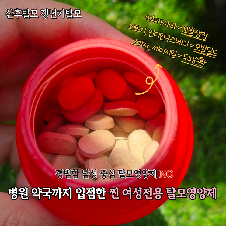  똥머리할때 정수리 자꾸 휑해져서 먹어본 여성전용 탈모영양제 솔직후기