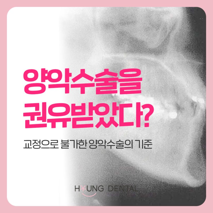  양악 수술 기준? 수원 치아교정 시작 전 필독