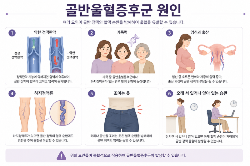 [하지정맥류 제주 수 흉부외과] 골반울혈증후군과 음부정맥류