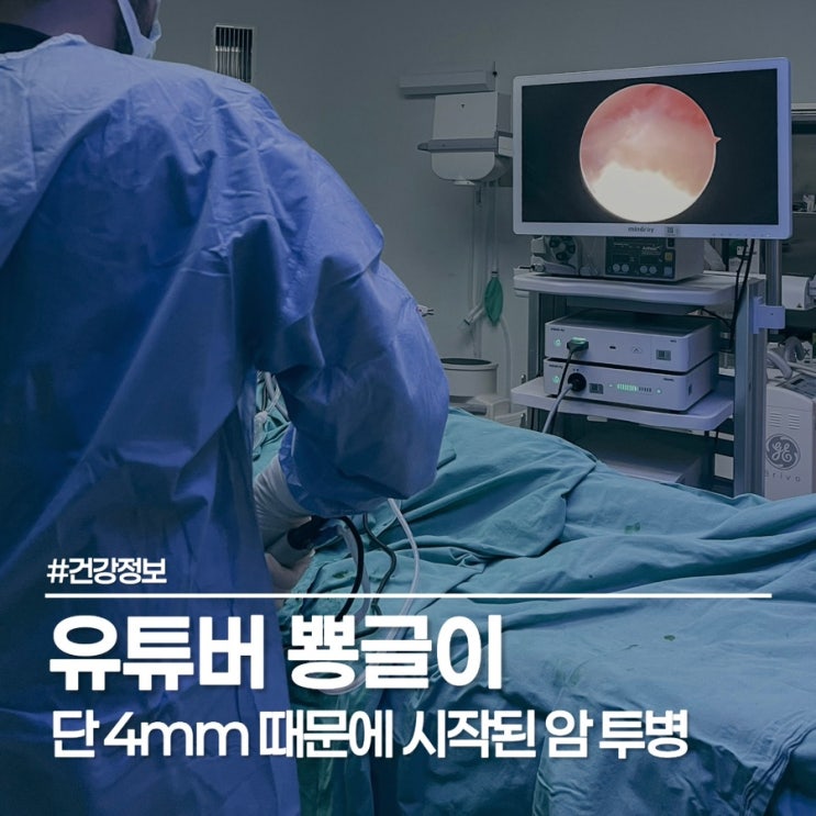  유튜버 뿅글이 20대 암 진단 충격, 4mm 직장 유암종의 경고