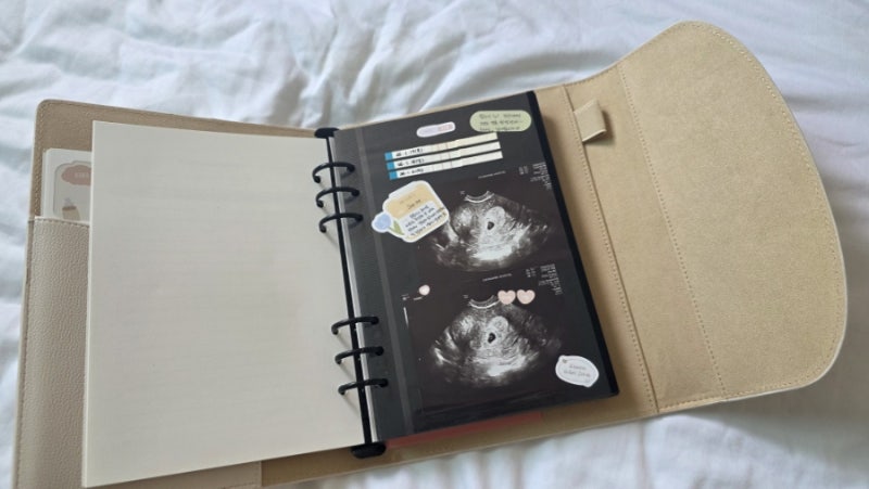 [임신 일상] 말띠맘 임신 선물, 모이라비 초음파 앨범 추천