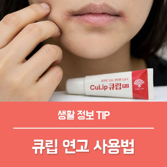 큐립 연고 효과, 입술 염증 원인과 증상 구각염 구순염 연고 사용법