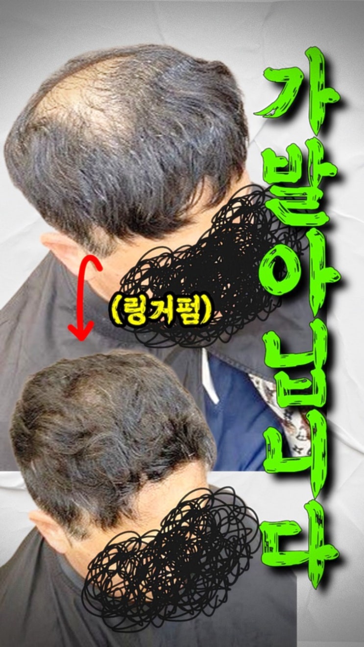  광교 정수리탈모 때문에 흑채 뿌리던 60대 남성 고객님… 결국 수원까지 오신 이유