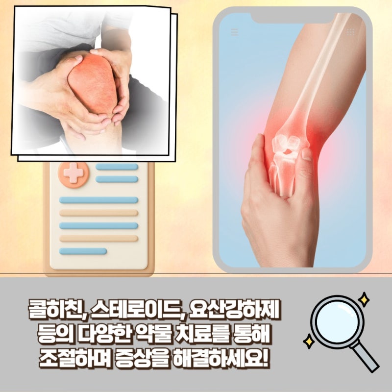 서울 서초 갑작스러운 관절의 불편함이 통풍초기증상일 수 있습니다