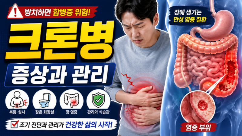 [건강 정보] 젊은 층 울리는 만성 장염, '크론병'의 원인·증상·치료법 총정리