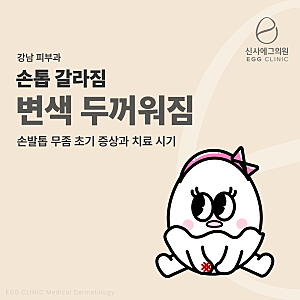 강남 피부과 손톱 갈라짐 변색 두꺼워짐, 손발톱 무좀 초기 증상과 치료 시기