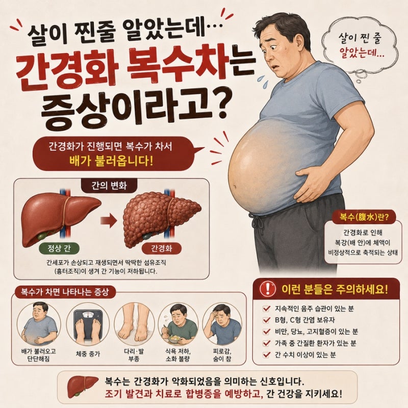 배가 불러오고 다리가 붓는다면? 간경화 증상 복수 차는 증상입니다