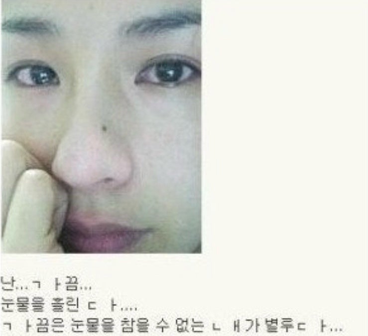 대구 여성 치질 수술 후기 3편 (퇴원 후 첫 배변, 외래, 응급실 다녀온 썰)
