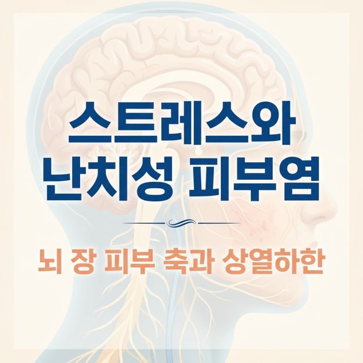  스트레스성 안면 지루성피부염 아토피 원인, 상열하한 열독과 한의원 면역 치료