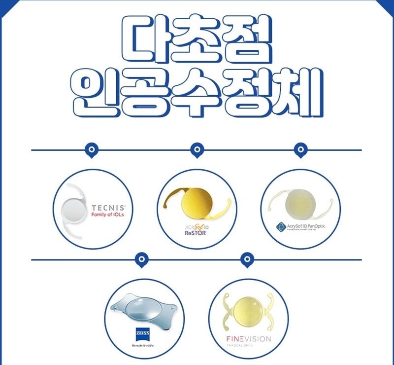 ICL 안내렌즈삽입술 한지 18년 지난 후 라섹 추가 수술 - 3편 다초점 인공수정체 수술 선택하....