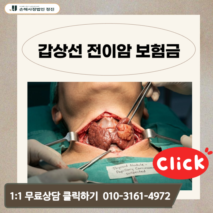  갑상선 전이암 보험금, 놓치고 계신가요? 손해사정사가 밝히는 일반암 수령의 비밀