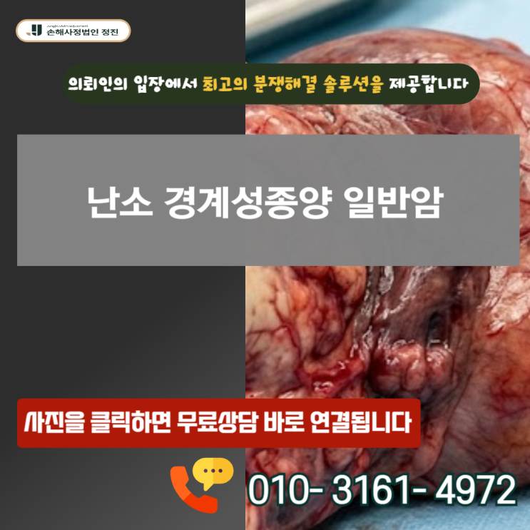  난소 경계성종양 일반암, D39.1 코드 받고도  전액 받아낸 비법