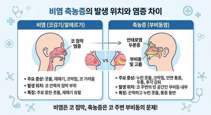 콧물 색 비염 축농증 발생 위치와 염증 차이 코 질환 까지 한눈에정리