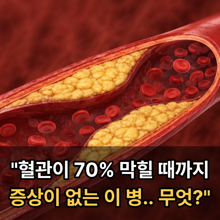  "혈관이 70% 막힐 때까지 증상이 없는 이 병.. 무엇?"