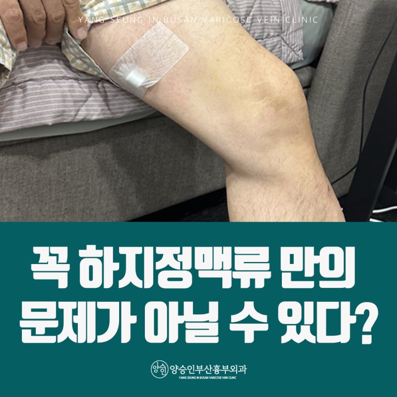 하지정맥류병원 추천, 타 병원에서 왜 양승인부산흉부외과를 이야기할까요?