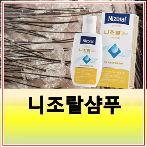 비듬없애는방법 니조랄 샴푸 약국 가격 사용법