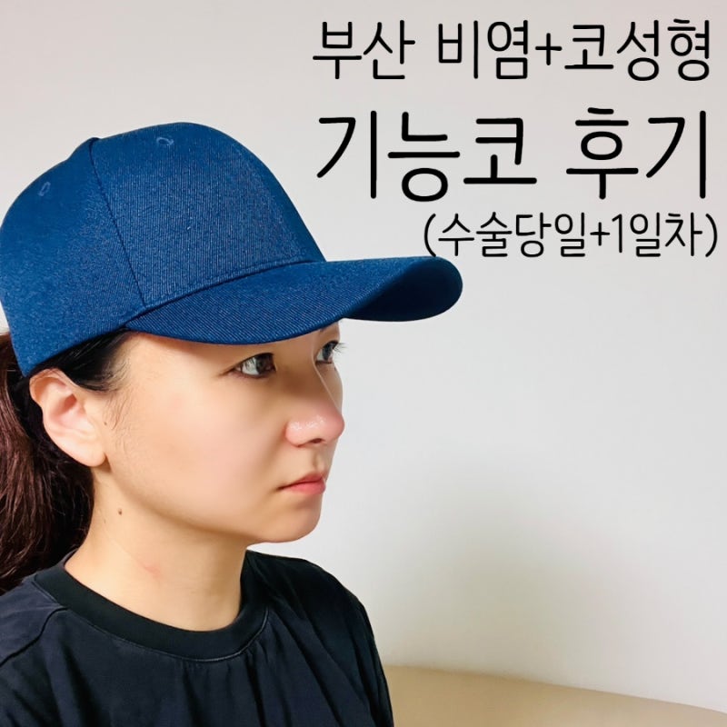 부산 비염·코성형 기능코 수술당일·1일차 후기, 수술비용·실비청구 금액까지