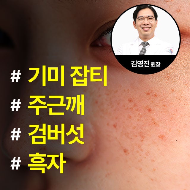 흑자 검버섯 쥐젖 비립종 제거, 신정네거리역 피부과 전문의 안전한 피부 치료