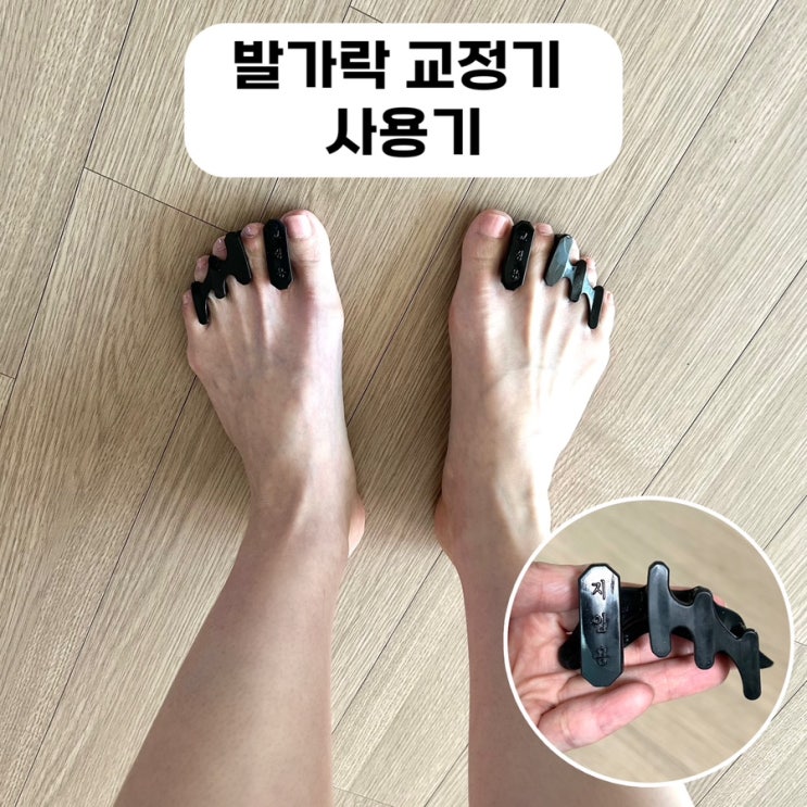  발가락교정기 사용기｜발모양 고민 있는 분들께 솔직 후기