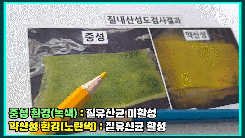 CIN1 자궁경부이형성증 1단계 자연치유 가능한 상황은
