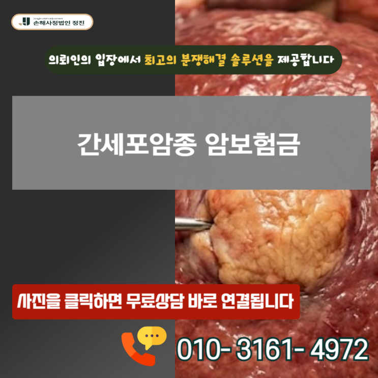  간세포암종 암보험금, 조직검사 없이 100% 받아낸 실무 역공 전략