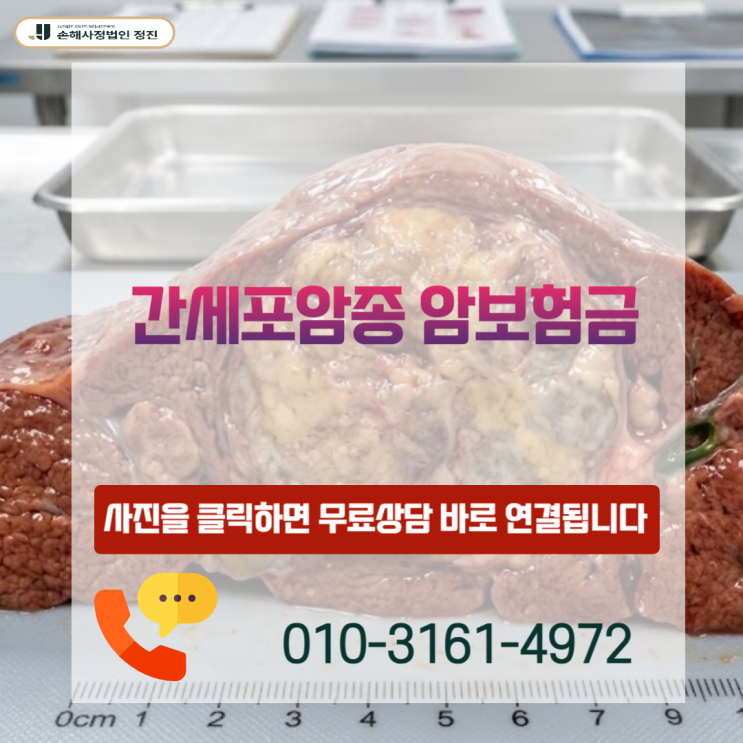  간세포암종 암보험금, 조직검사 없이 대기업 보험사 상대로 전액 받아낸 비결