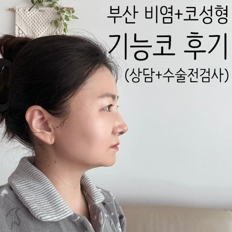 부산 비염·코성형 기능코 수술 후기, 상담과 수술 전 검사
