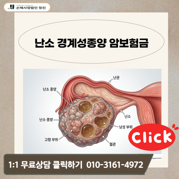  난소 경계성종양 암보험금, D39.1 코드 받고도 전액 수령한 비밀은?