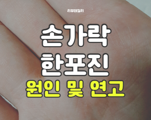 손가락 한포진 원인 및 연고, 전염 가능할까? 증상부터 관리법까지 총정리