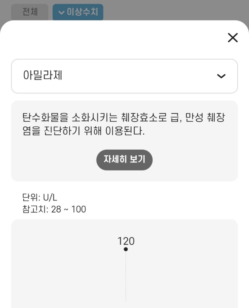 정상체중 마운자로 건강검진 결과 이상, 췌장수치 증가로 마운자로 중단