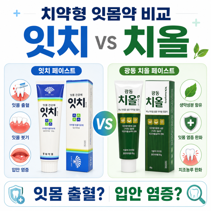 치약형 잇몸약 비교: 잇치 vs 광동 치올 페이스트 성분·효능·사용법 차이- 종로백제약국