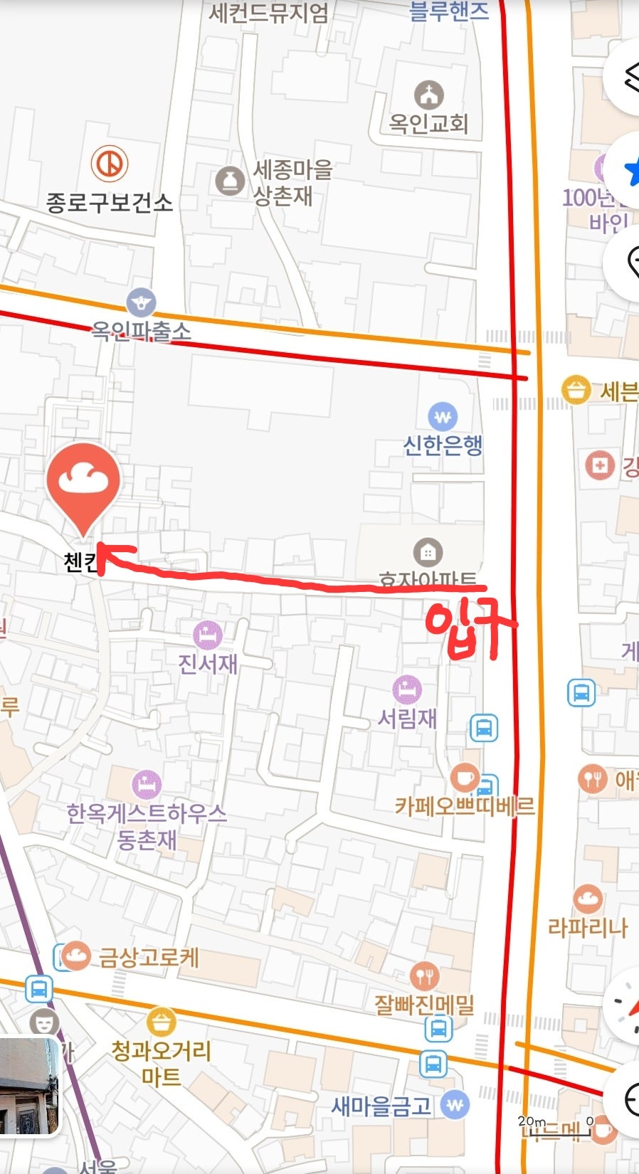 첸킨 사진 3
