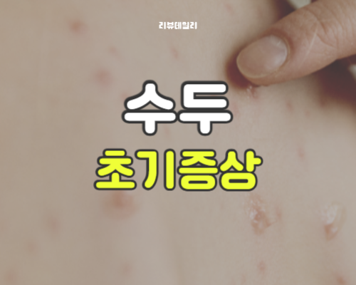 아기 수두 초기증상 배·얼굴 발진 및 열, 꼭 알아야 할 증상 총정리