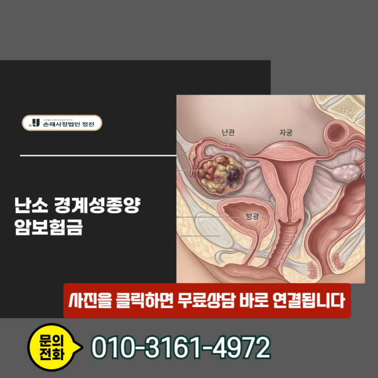 난소 경계성종양 암보험금, 소액 지급 통보를 뒤집는 병리 보고서의 비밀