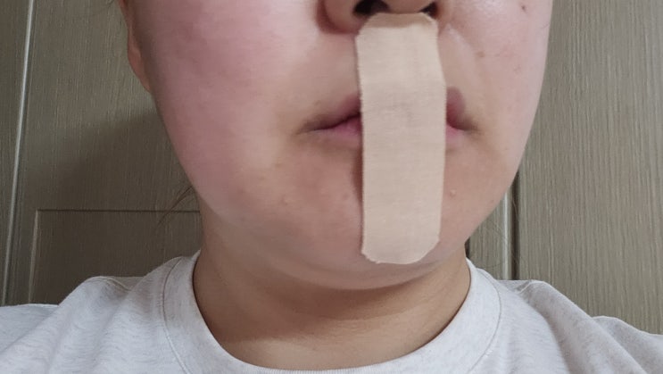  입벌림방지밴드 다이소 3주 써봤는데 비강확장기로 갈아탄 이유