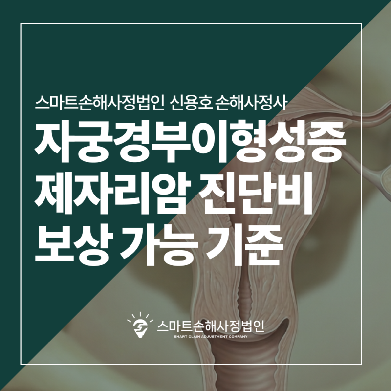 자궁경부이형성증 진단비, N87 코드도 제자리암 보상 가능? (feat. 부산 손해사정사)