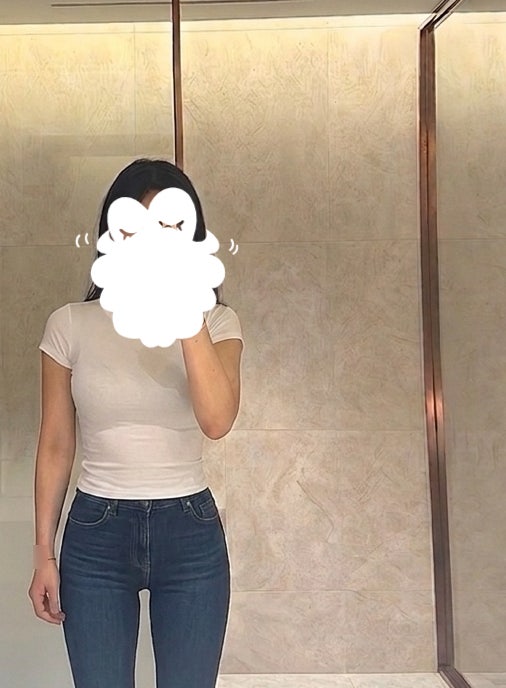  부산팔뚝지흡 부산지방흡입 서면지방흡입 팔뚝지흡 내돈내산 후기(붓기,통증,부작용 등)