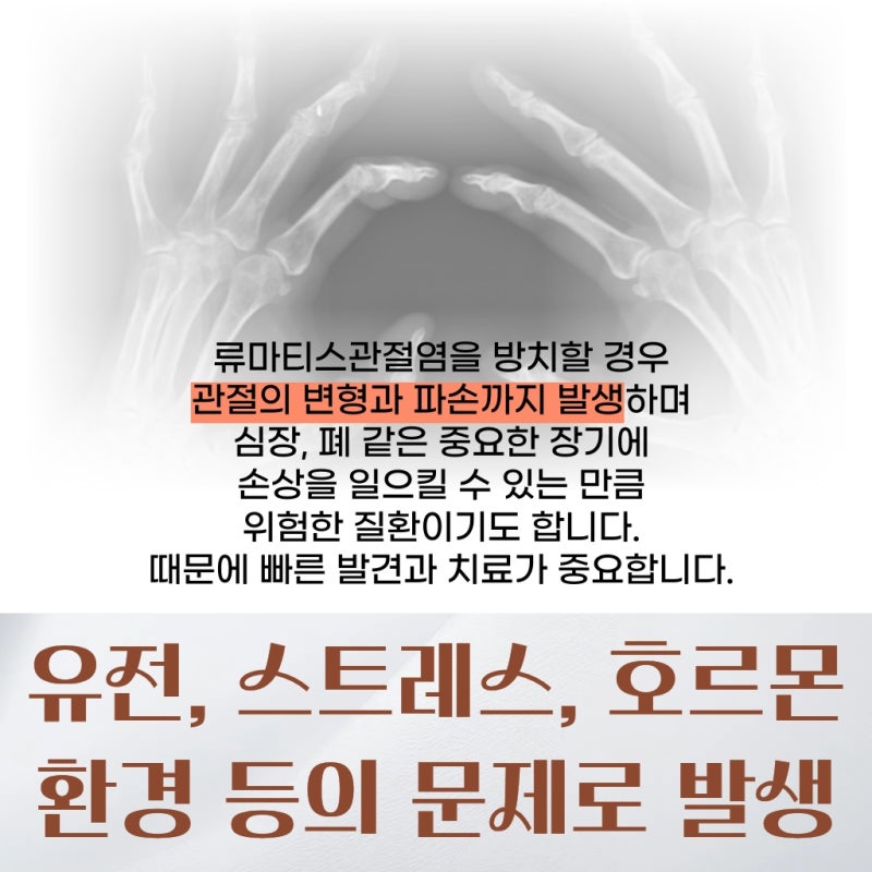 인천 남동 이유 없는 관절 통증 류마티스관절염 내과 진료가 필요한 이유
