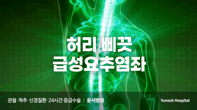 허리 삐끗 했을 때, '급성요추염좌' 이렇게 치료합니다 - 구리신경외과 윤서병원