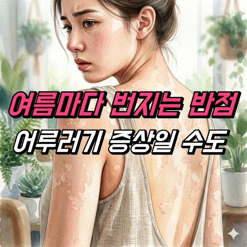 피부 어루러기 치료 연고, 증상 관리법