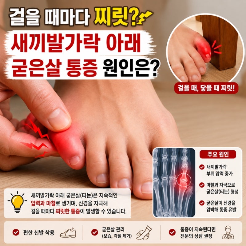 걸을 때마다 찌릿? 새끼발가락 아래 굳은살 통증 티눈일까요?