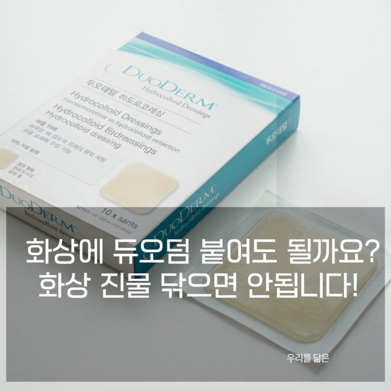 화상에 듀오덤 붙여도 될까? 진물 나는 상처 관리법과 올바른 사용법 완전 정리