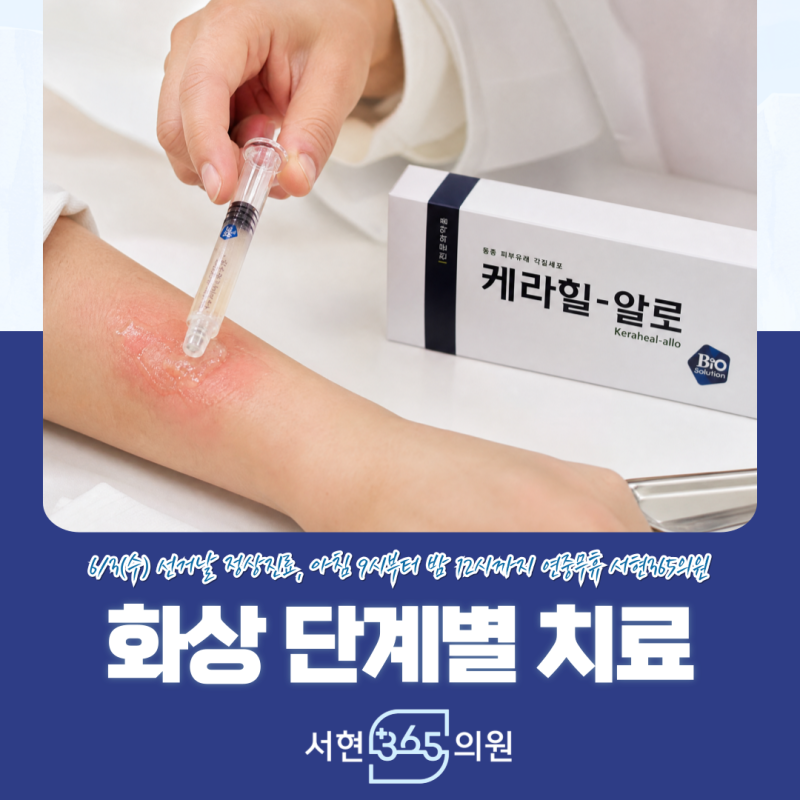 화상 물집 생겼을 때, 밴드와 연고 선택 기준 분당 판교 서현365의원