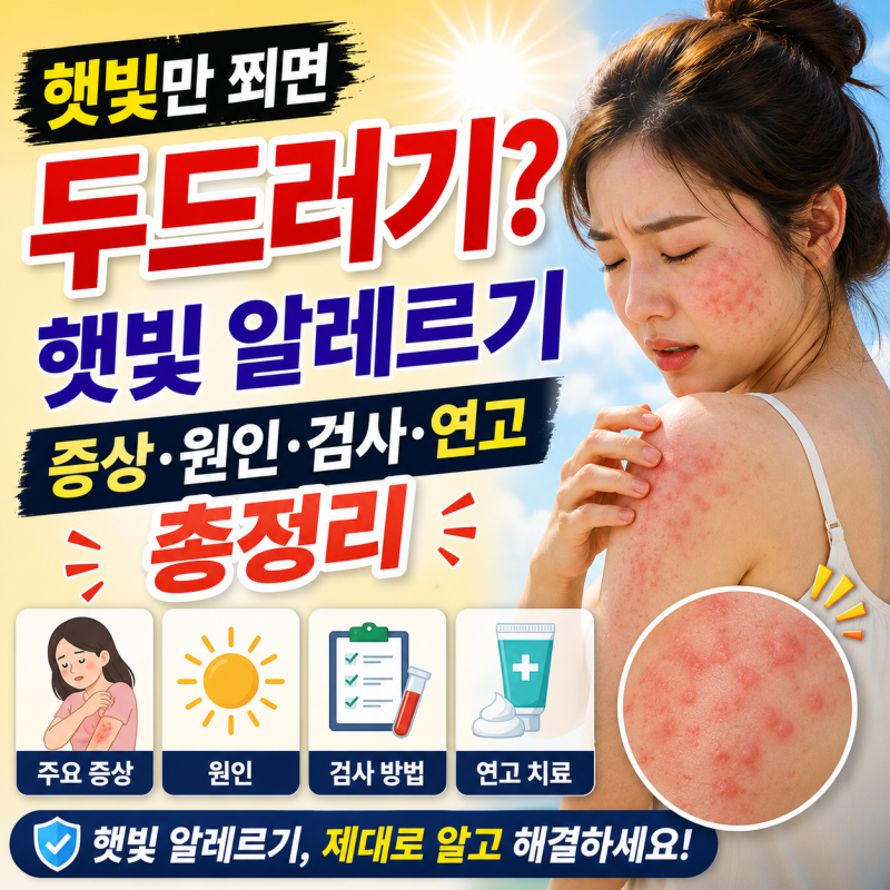 햇빛만 쬐면 두드러기? 햇빛 알레르기 증상·원인·검사·연고 총정리