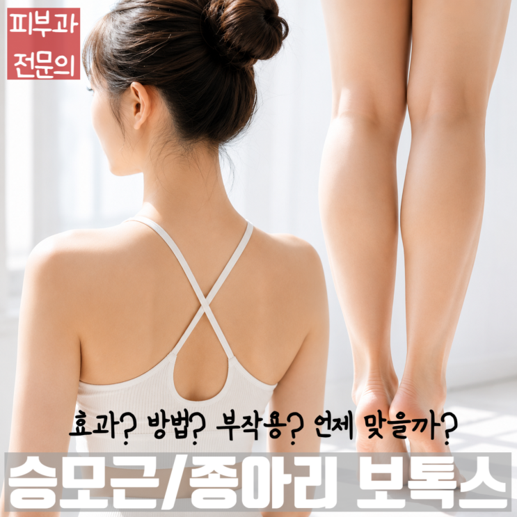  승모근/종아리 보톡스의 효과, 방법, 부작용 - 여름/휴양지/드레스를 대비하는 윤곽술/체형보톡스