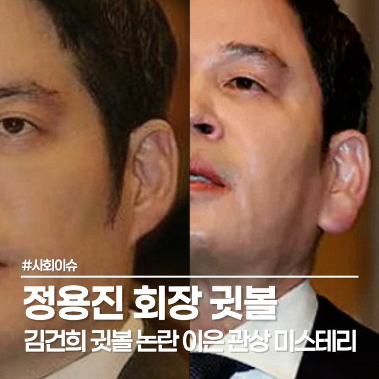  신세계 회장 정용진 귀필러 시술설, 기자회견 영상 속 바뀐 귓볼 논란