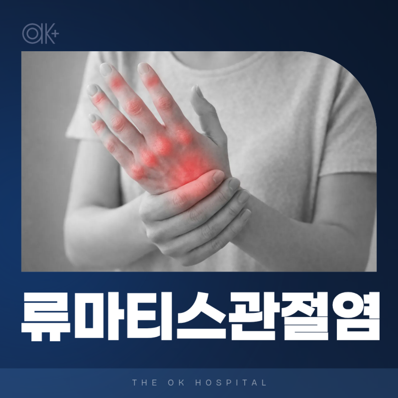 춘천류마티스 손가락변형과 함께 전신피로까지 이어진다면